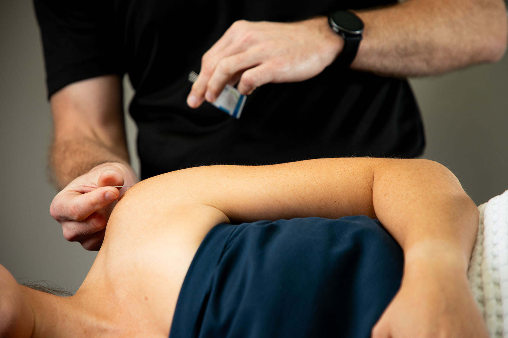 What Is Dry Needling and How Does it Help Physio Patients? 