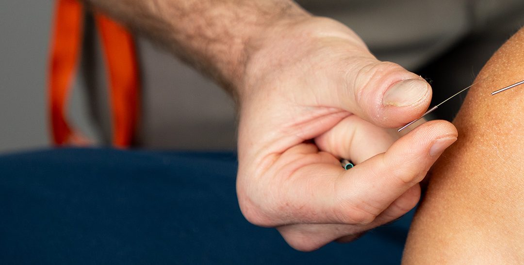How long does it take for acupuncture to work?
