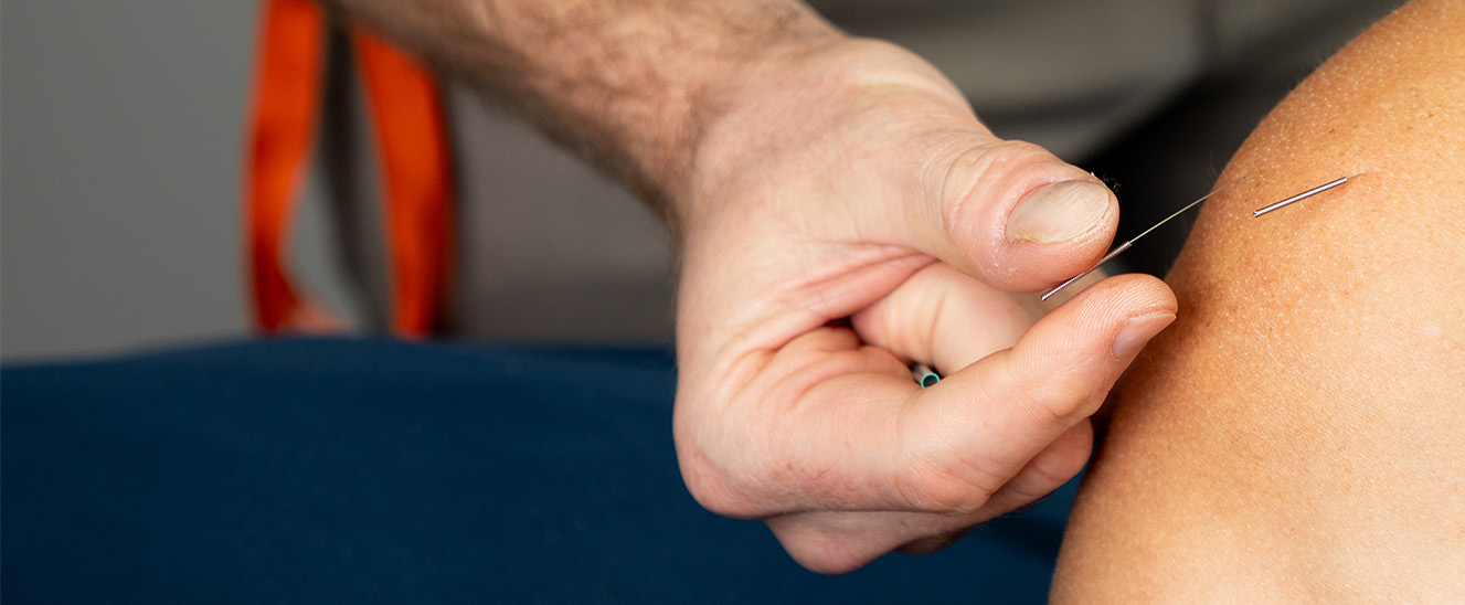How long does it take for acupuncture to work?